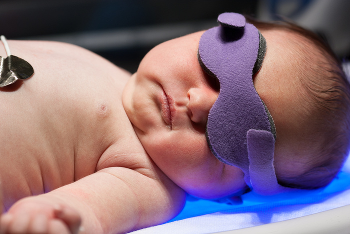 Newborn Baby Receiving Uv Phototherapy